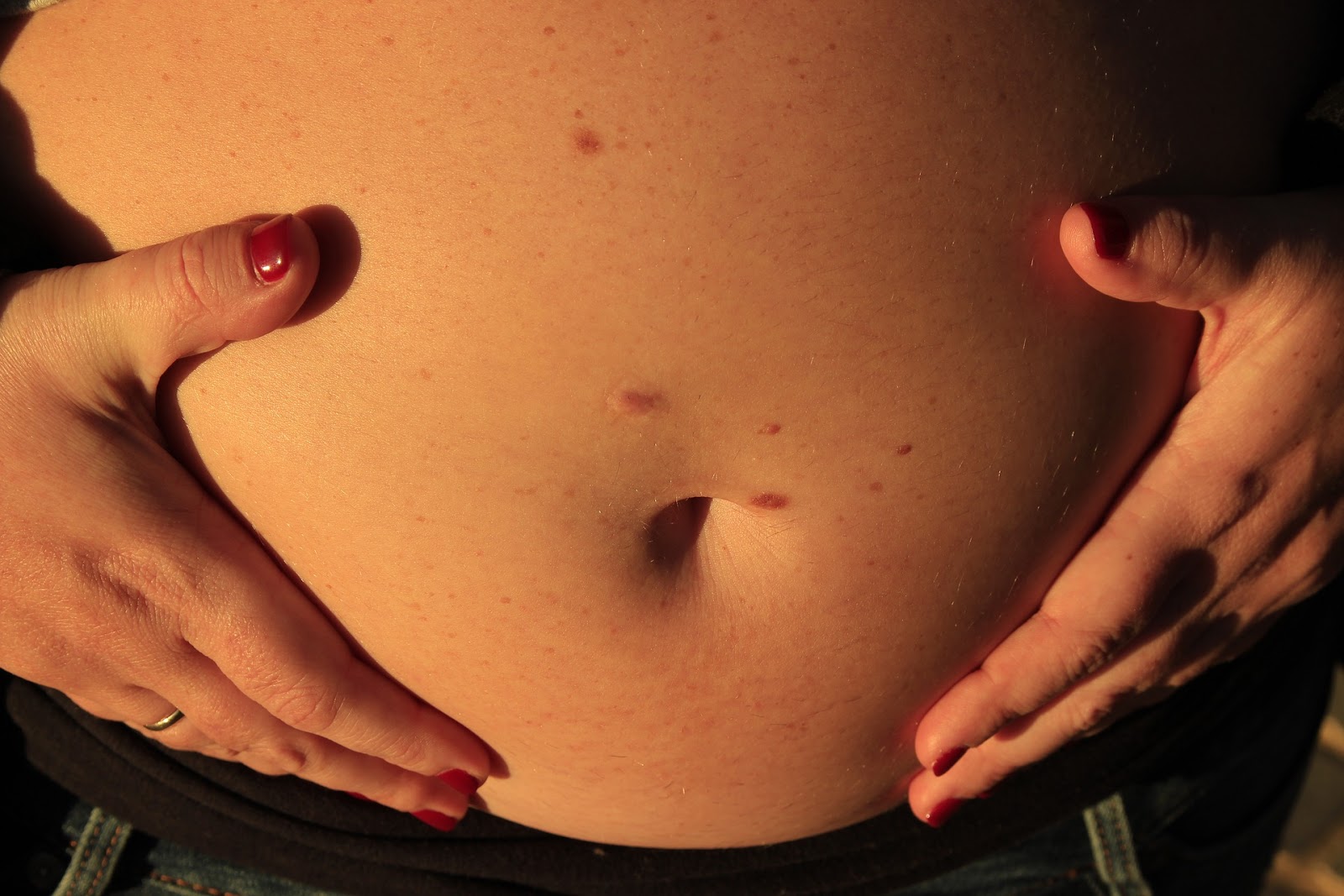 сыпь на груди животе при беременности фото 28