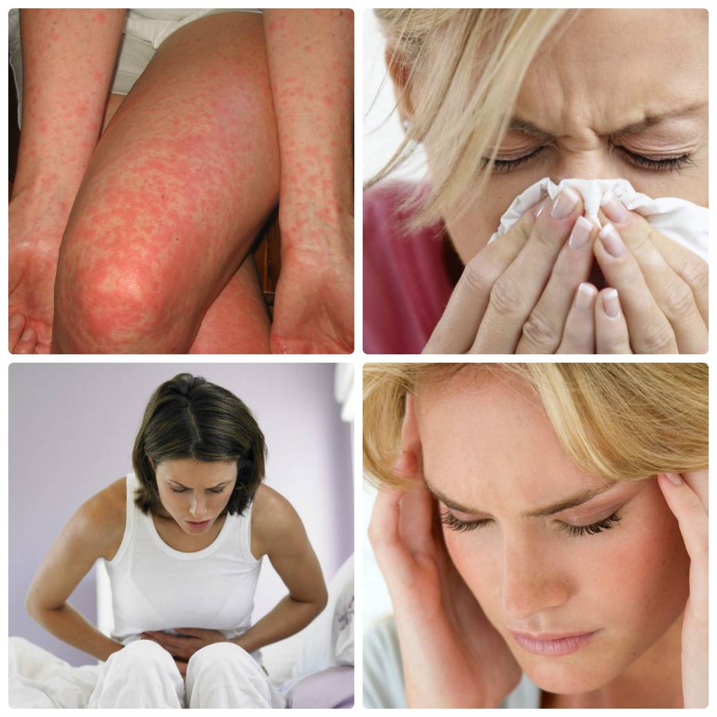 Аллерги
