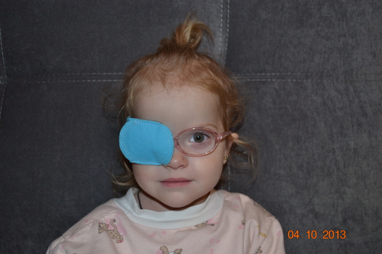 Ребенок косит глазки. Коррекционные очки от косоглазия. Ребёнок 1.5 года косит глаз. Косит глаз у ребенка 7 лет. Скосил глаза ребенок.