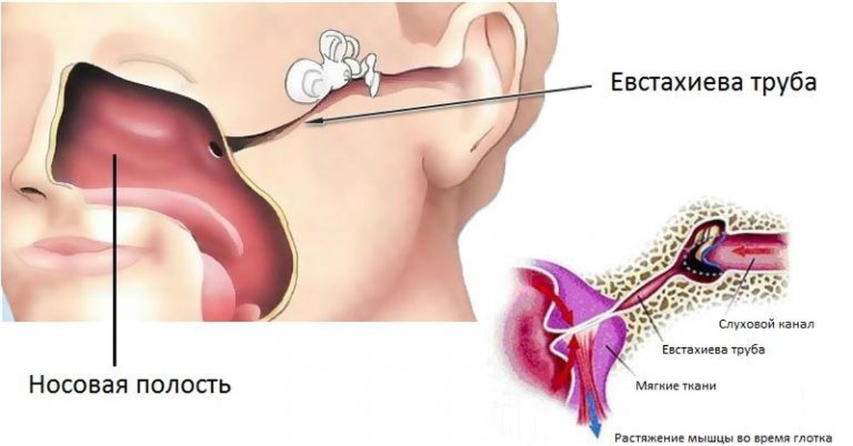 Глотаю закладывает ухо. Евстахиева труба соединяет полость среднего уха с носоглоткой. Анатомия уха и евстахиевой трубы. Евстахиева труба и носоглотка.
