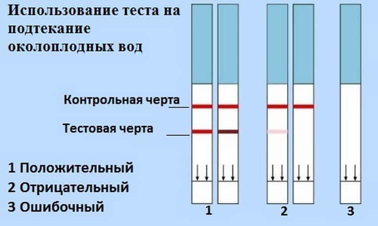 Как понять подтекают. Тест на подтекание околоплодных вод. Пиотыкание окоплодныхвод. Подтекание околоплодных од. Тест на излитие околоплодных вод.