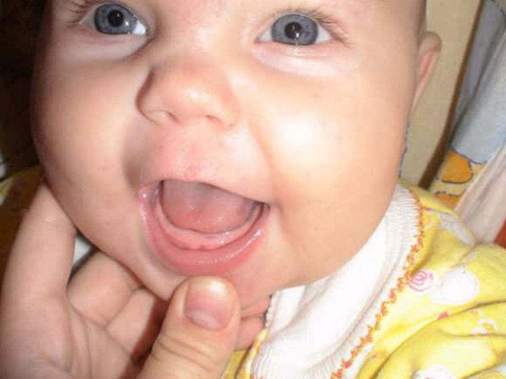 Лезут зубы у ребенка постоянно. Прорезывание первых зубов. Десна при прорезывании первых зубов.