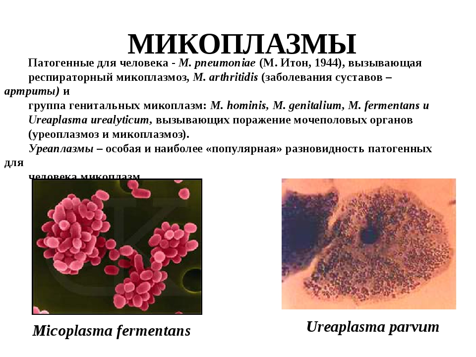 Лечение микоплазмоза у женщин