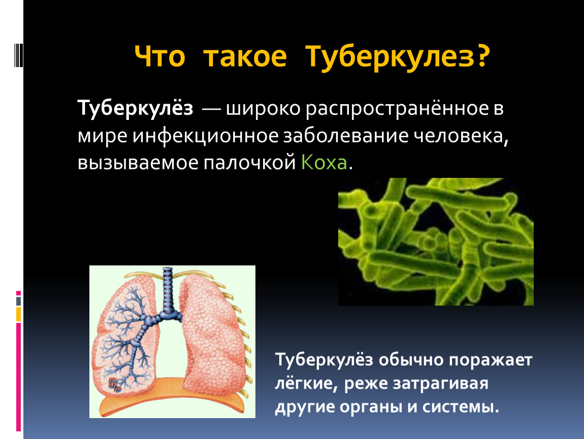 Заболевание туберкулез у человека вызывает. Палочка Коха туберкулез. Туберкулез вызывается.