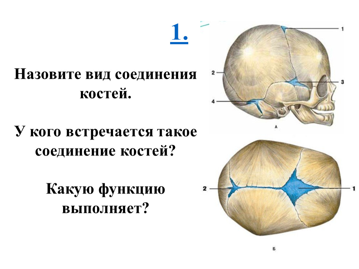 Кости и швы черепа