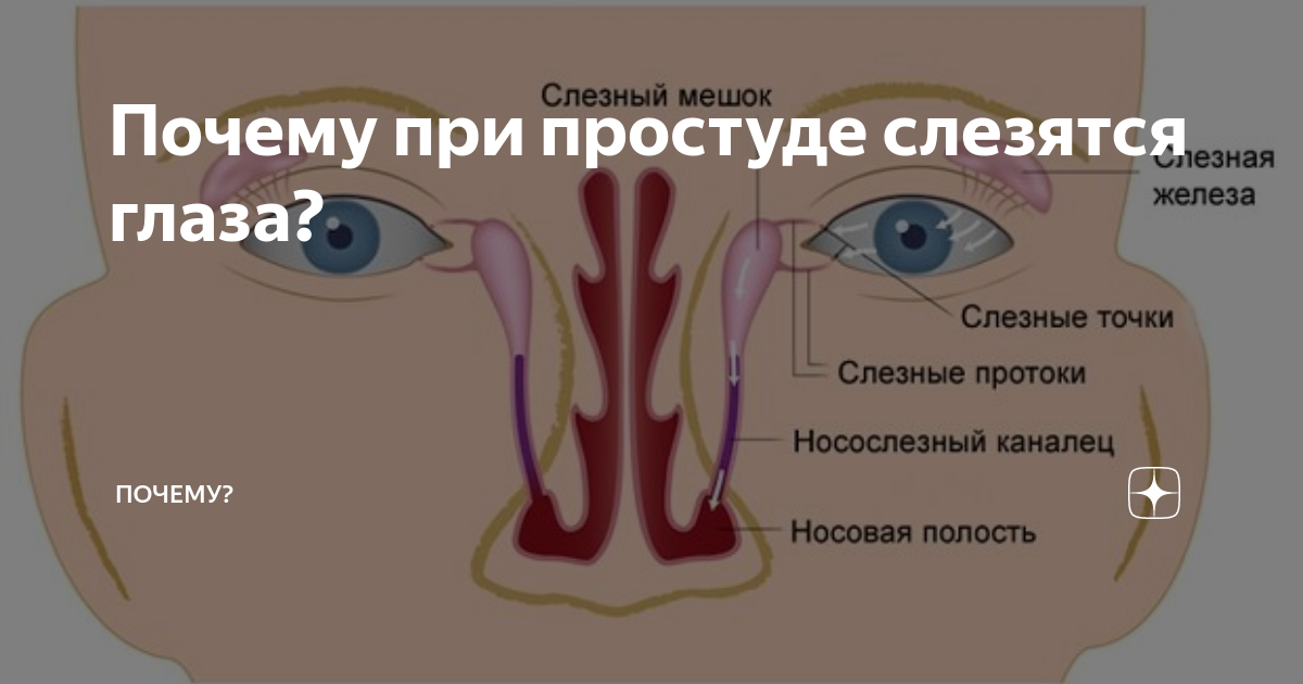 Из ноздри течет вода. Причины слезотечения глаза. Слезотечение при простуде.