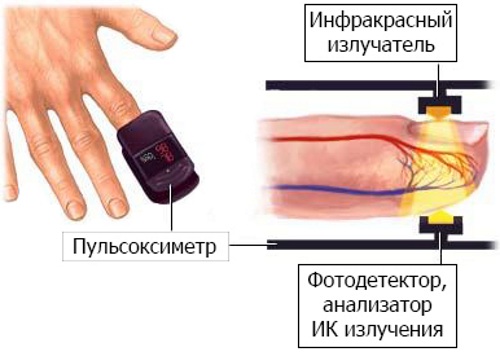 Уровень кислорода в крови. Норма у взрослых, пожилых людей, ребенка, что это значит, как измерить