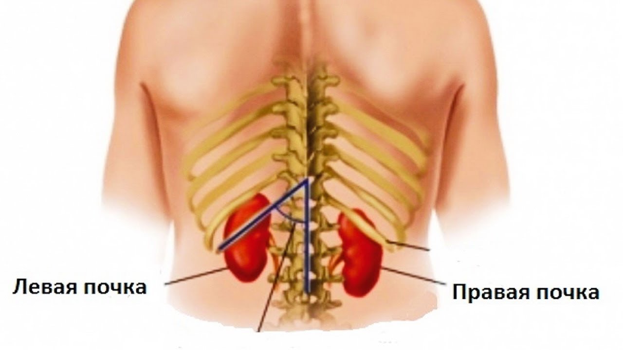Болит спина и левое ребро. Почки у человека расположение. Схема расположения почек у человека.