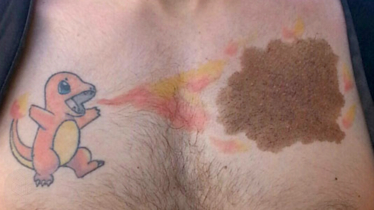 Татуировка на родимом пятне