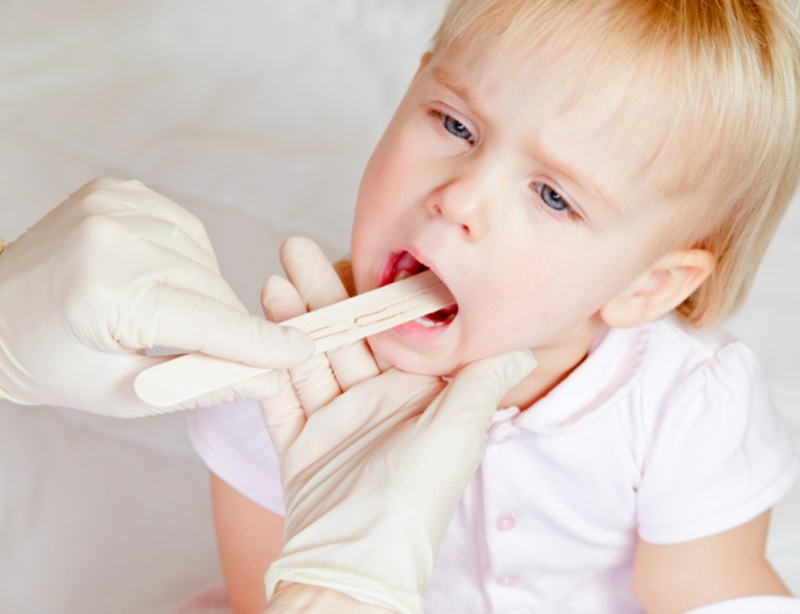Чем обрабатывать молочницу. Кандидоз днтец во рту у детей. Обработка полости рта у детей.
