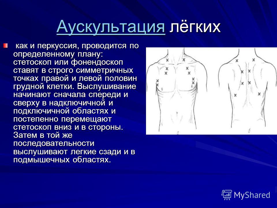 Точки аускультации легких схема