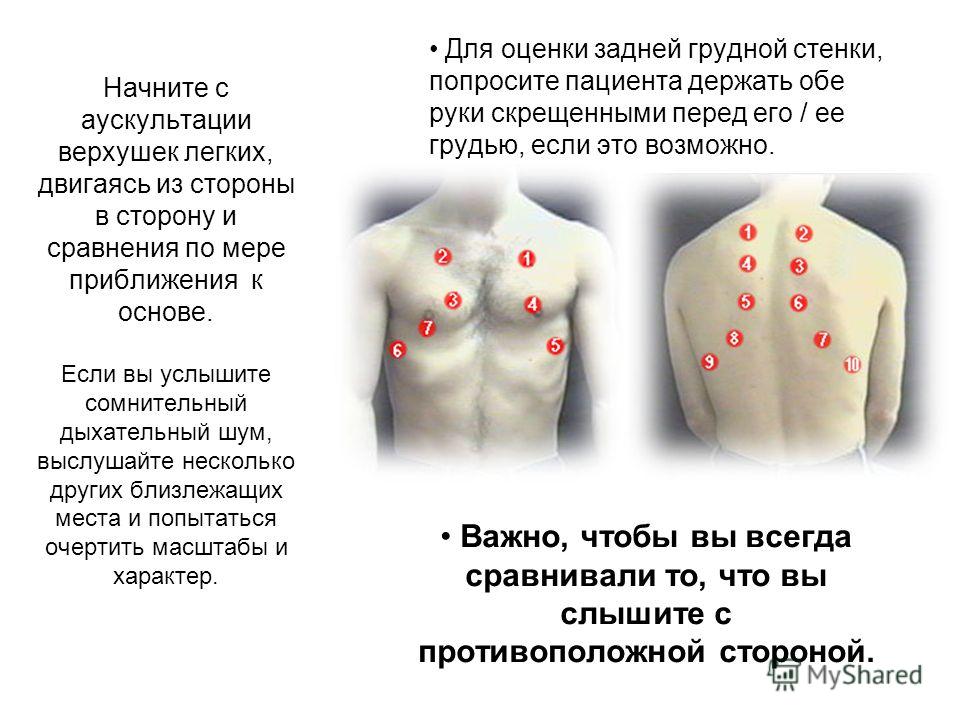 Точки аускультации легких в картинках