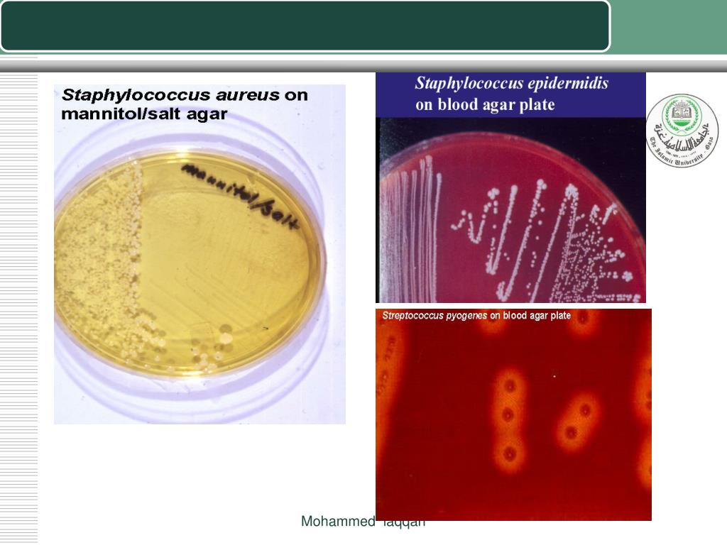 Staphylococcus aureus золотистый стафилококк