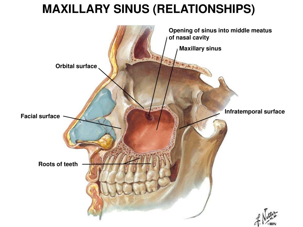 Болят синусы. Строение зуба и гайморовой пазухи. Слизистая гайморовой пазухи строение. Строение слизистой гайморовой пазухи. Одонтогенный гайморит верхнечелюстной пазухи.