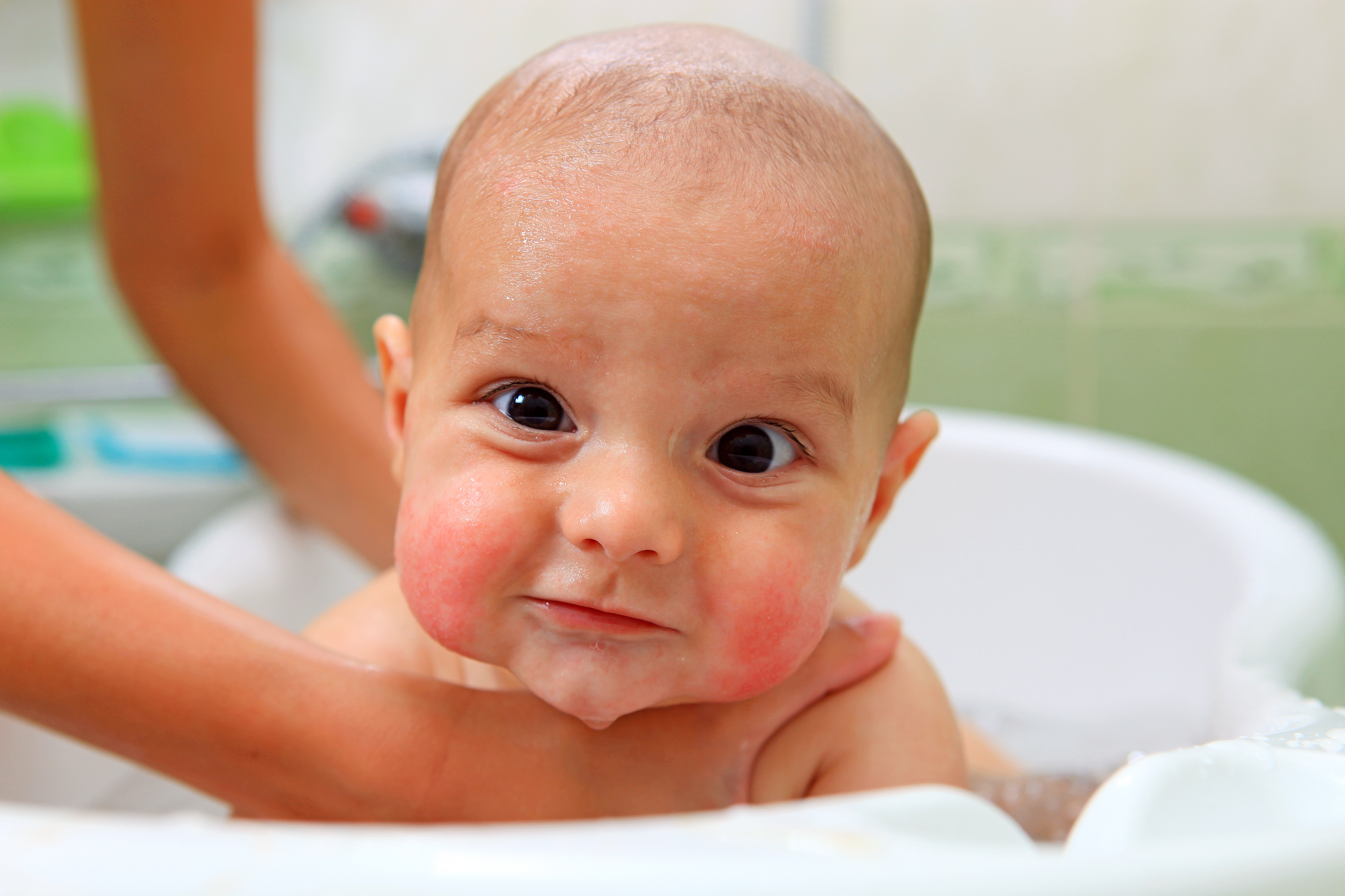 Малыш после купания. Атопический дерматит у детей. Атопический дерматит у младенца.