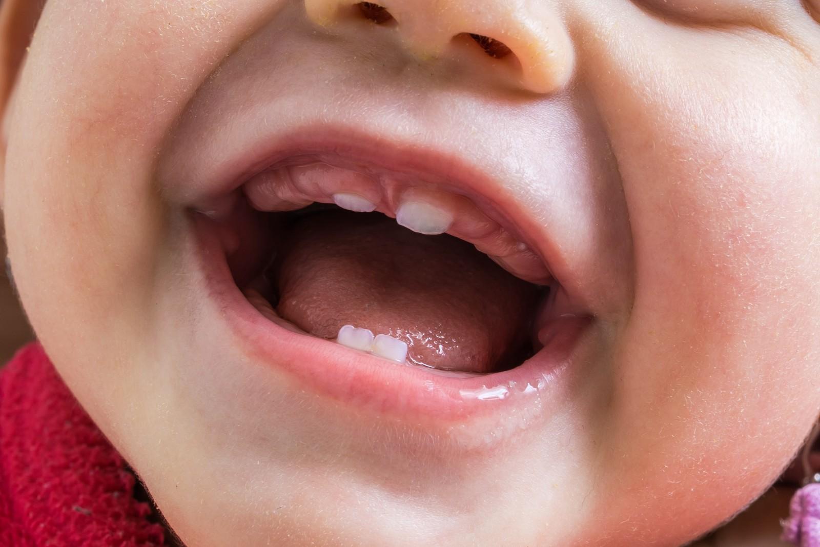 Прорезывание зубок – важный этап в жизни каждого грудничка
