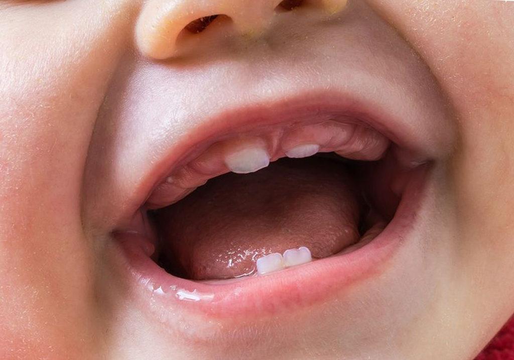 Нарушения в режиме дня часто наблюдаются в период прорезывания зубов