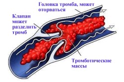 Польза болгарского перца при тромбофилии