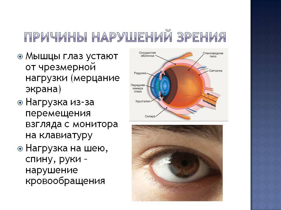 Глазное зрение 1. Проявления (симптомы) нарушений зрения (зрительного восприятия).. Причины нарушения остроты зрения. Причины возникновения нарушения зрения. Причины патологии зрения.