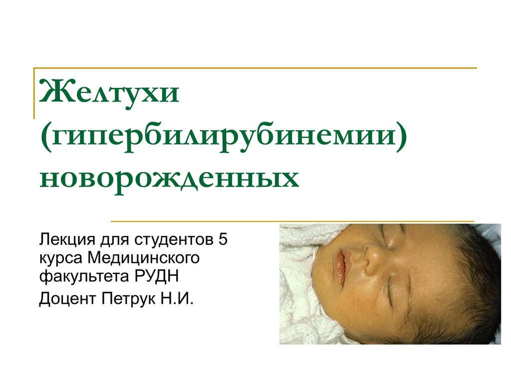 Желтуха симптомы у детей. Гипербилирубинемия желтуха новорожденных. Конъюгационная гипербилирубинемия у новорожденных. Транзиторная желтуха новорожденных. Транзиторная гипербилирубинемия у новорожденных.