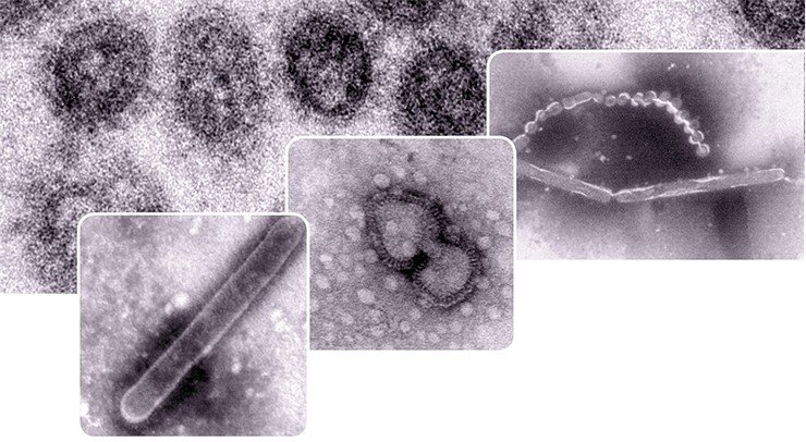 Электронно-микроскопические «портреты» частиц вируса гриппа (вирионов) в суспензии. Метод негативного контрастирования позволяет выявить тонкие детали на поверхности вирусных частиц. У вируса гриппа это, например, шипики, представляющие собой молекулы гемагглютинина и нейраминидазы