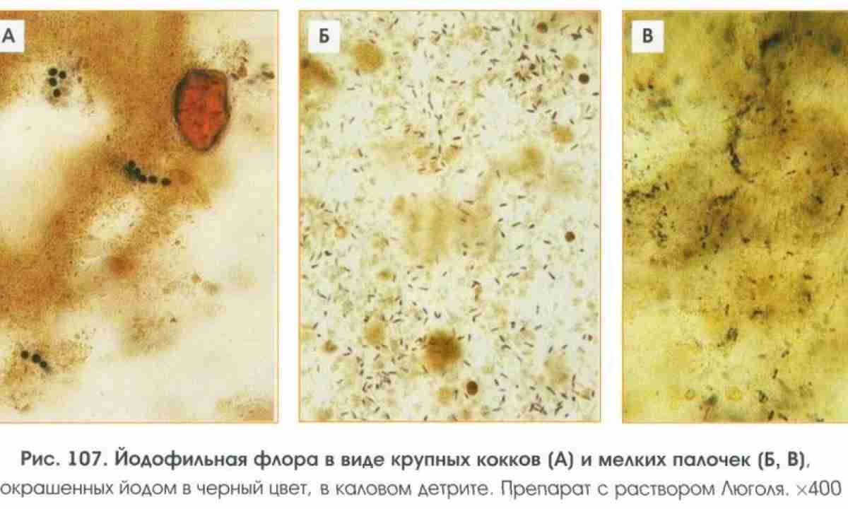 Копрограмма грибы обнаружены у взрослого. Микроскопия кала детрит.