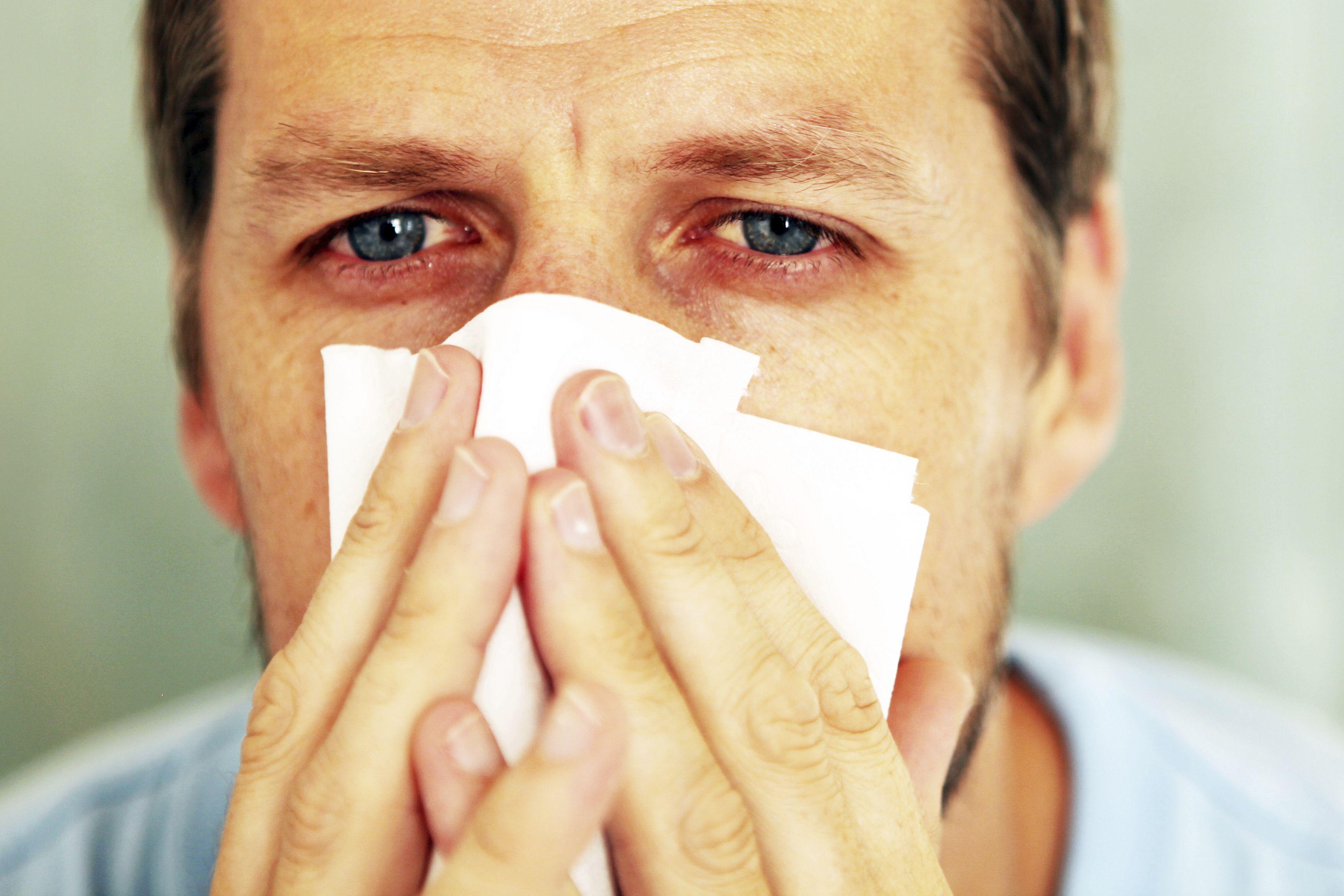 Хроническая заложенность носа у взрослых. Человек с насморком. Респираторная аллергия.